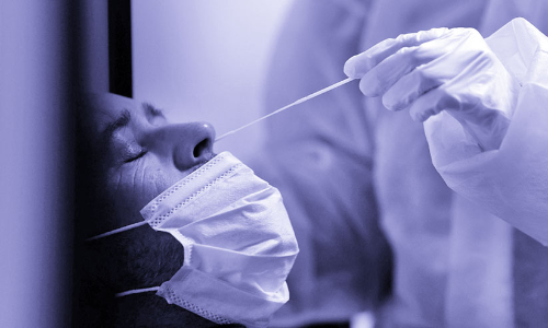 പി.​സി.​ആ​ർ ഫ​ലം കി​ട്ടാ​ൻ വൈ​കു​ന്നു; യാ​ത്ര​ക്കാ​ർ ശ്ര​ദ്ധി​ക്ക​ണം