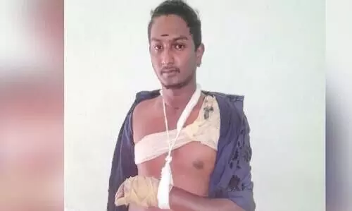 Young man beaten Police fail to arrest culprits