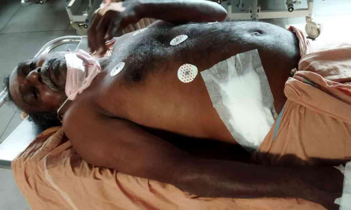 പന്നിയുടെ ആക്രമണത്തിൽ വയോധികനായ ഓട്ടോ ഡ്രൈവർക്ക് പരിക്ക്