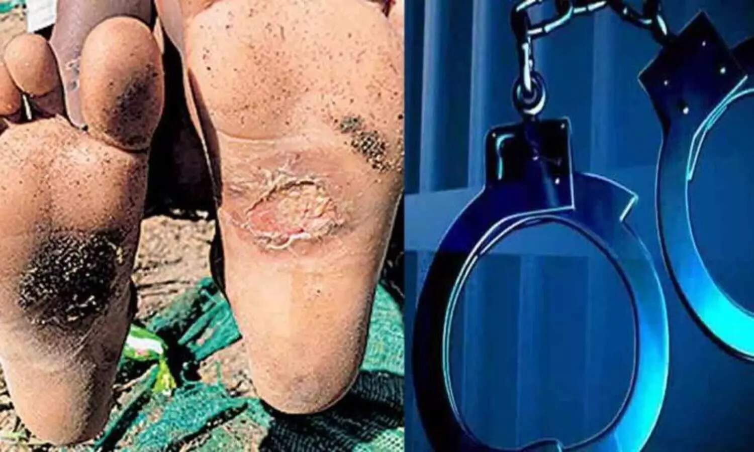 അഞ്ചു വയസ്സുകാരന്‍റെ കാൽവെള്ളയിൽ പൊള്ളലേൽപിച്ച മാതാവ് അറസ്റ്റിൽ