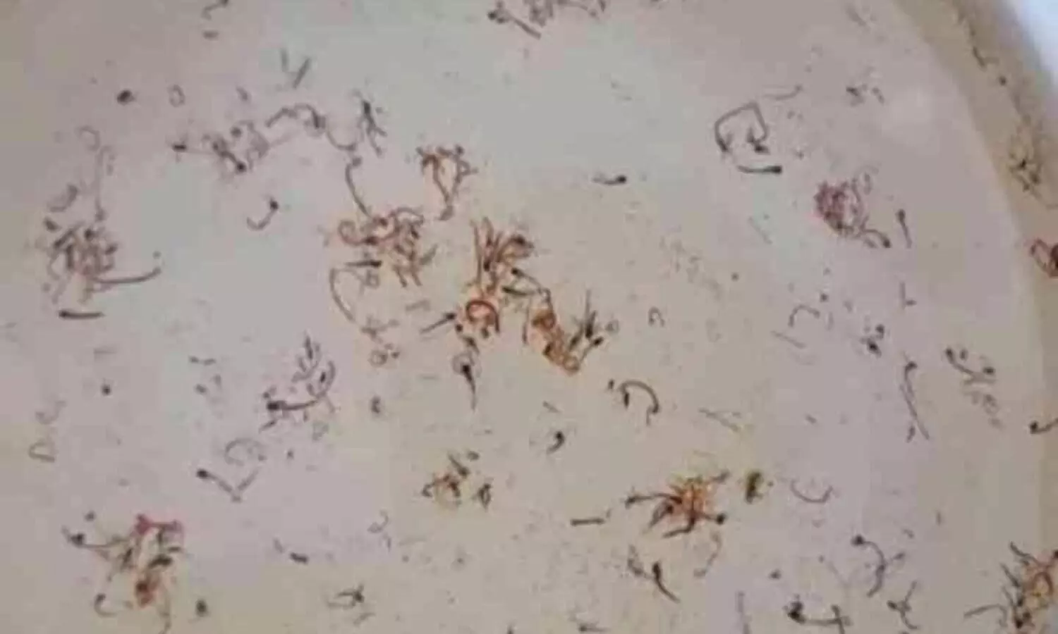 കുടിവെള്ളത്തിൽ കൃമികളും പുഴുക്കളും