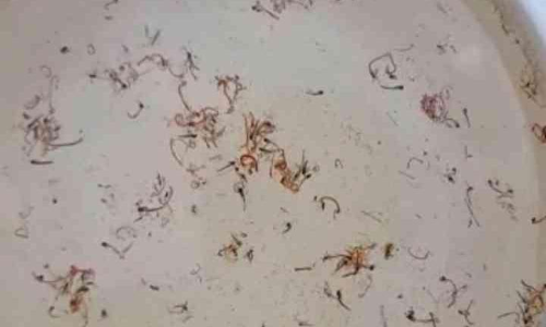 കുടിവെള്ളത്തിൽ കൃമികളും പുഴുക്കളും