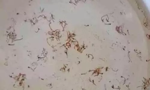 കുടിവെള്ളത്തിൽ കൃമികളും പുഴുക്കളും