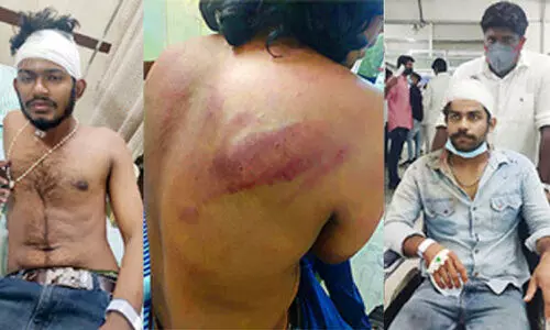 ധീ​ര​ജ് വധം: വിവിധയിടങ്ങളിൽ അക്രമം; മഹാരാജാസിൽ 10 കെ.എസ്.യുക്കാരെ എസ്​.എഫ്​.ഐ സംഘം മർദിച്ചു