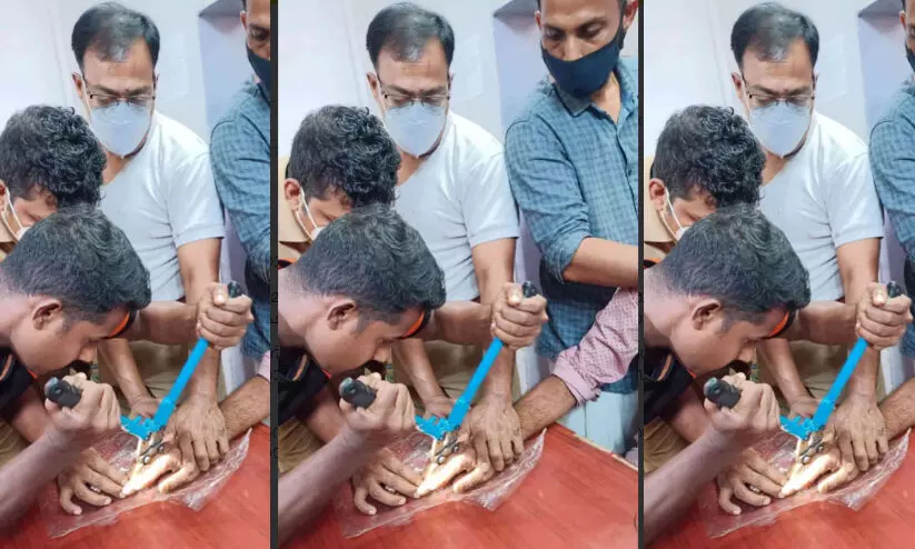 വർഷങ്ങൾക്ക് മുമ്പണിഞ്ഞ മോതിരങ്ങൾ പണിയായപ്പോൾ ഡോക്ടറും സ്വർണപ്പണിക്കാരനും കൈയ്യൊഴിഞ്ഞു; തുണയായത് ഫയർ ഫോഴ്സ് വർഷങ്ങൾക്ക് മുമ്പണിഞ്ഞ മോതിരങ്ങൾ പണിയായപ്പോൾ ഡോക്ടറും സ്വർണപ്പണിക്കാരനും കൈയ്യൊഴിഞ്ഞു; തുണയായത് ഫയർ ഫോഴ്സ്