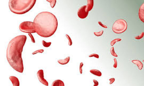 പെൻഷൻ മുടങ്ങിയിട്ട് ഒമ്പതു മാസം; മരുന്ന് വാങ്ങാൻ പണമില്ലാതെ അരിവാൾ രോഗികൾ