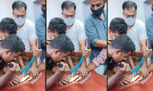 വർഷങ്ങൾക്ക്​ മുമ്പണിഞ്ഞ മോതിരങ്ങൾ പണിയായപ്പോൾ ഡോക്​ടറും സ്വർണപ്പണിക്കാരനും കൈയ്യൊഴിഞ്ഞു; തുണയായത്​ ഫയർ ഫോഴ്​സ്​