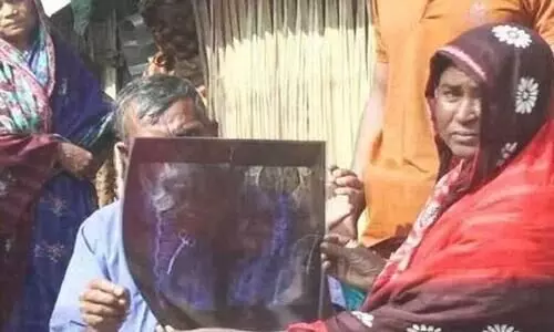 Doctors remove pair of scissors from womans stomach after 20 years