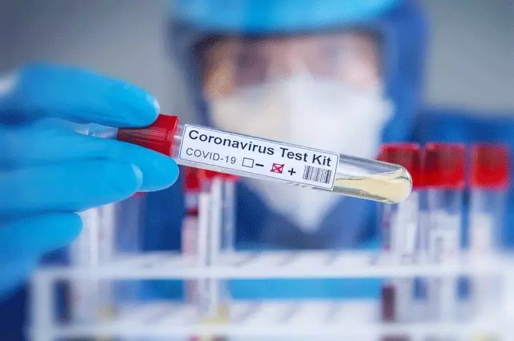 പോസിറ്റിവാകുന്നവർക്ക്​ ടിക്കറ്റ്​ റീഫണ്ടില്ല; പ്രവാസികൾക്ക്​ ദുരിതം