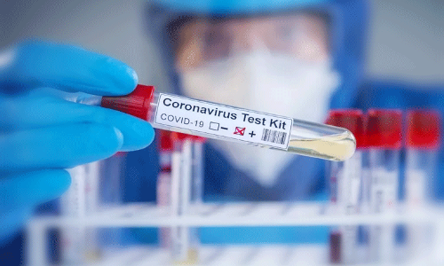 പോസിറ്റിവാകുന്നവർക്ക്​ ടിക്കറ്റ്​ റീഫണ്ടില്ല; പ്രവാസികൾക്ക്​ ദുരിതം