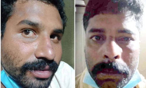 ഭക്ഷണം താമസിച്ചതിന് ഹോട്ടൽ ഉടമയെ മർദിച്ച പ്രതികൾ അറസ്റ്റിൽ