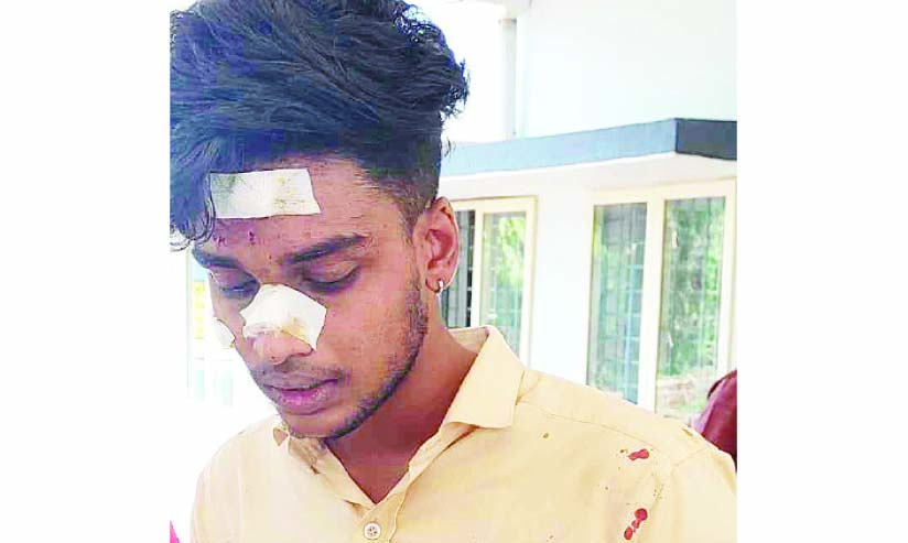 കു​ന്നം​കു​ള​ത്ത് എ​സ്.​എ​ഫ്.​ഐ-​എ.​ബി.​വി.​പി പ്ര​വ​ർ​ത്ത​ക​ർ ഏ​റ്റു​മു​ട്ടി; മൂ​ന്നു​പേ​ർ​ക്ക് പ​രി​ക്ക്