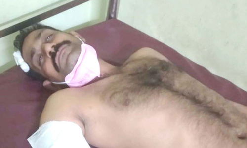 കാട്ടാനയുടെ ആക്രമണത്തില്‍ വനം വകുപ്പ് ജീവനക്കാരന് പരിക്ക്