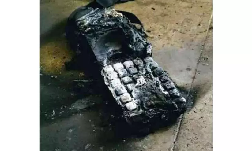 ടിക്കറ്റ് യന്ത്രം പൊട്ടിത്തെറിച്ച് കെ.എസ്.ആർ.ടി.സി കണ്ടക്ടര്‍ക്കും ഡ്രൈവര്‍ക്കും പരിക്ക്