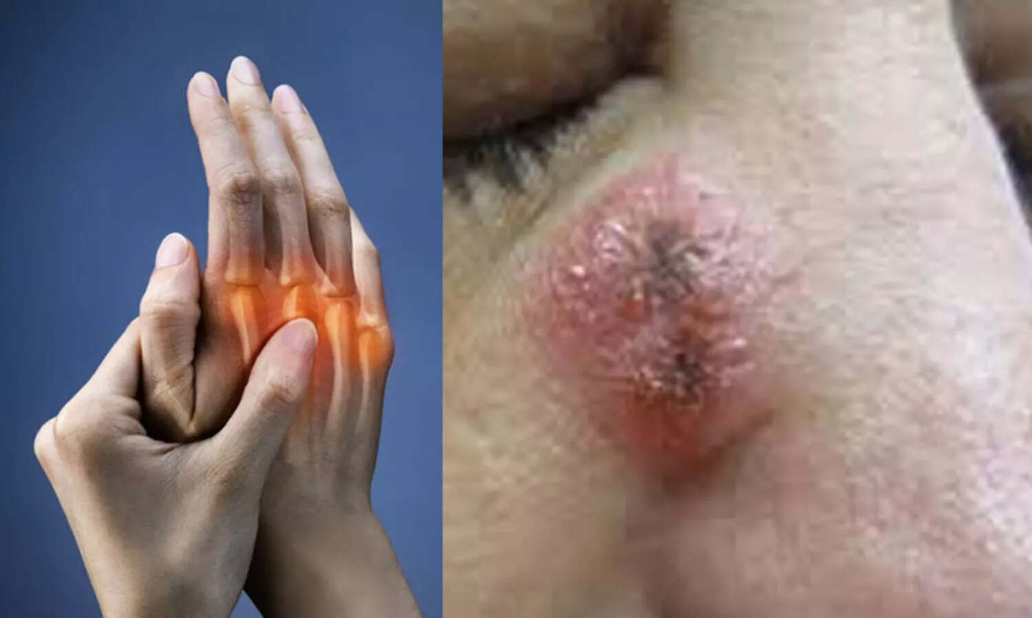 കോവിഡ്​ ഭേദമായവർക്ക്​ ഈ രോഗങ്ങളും ബാധിക്കുന്നതായി ഡോക്​ടർമാർ