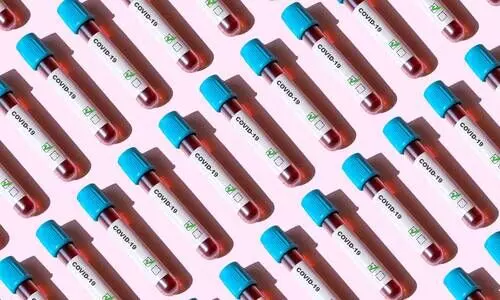 കോവിഡ്​: അവലോകന യോഗം ഇന്ന്