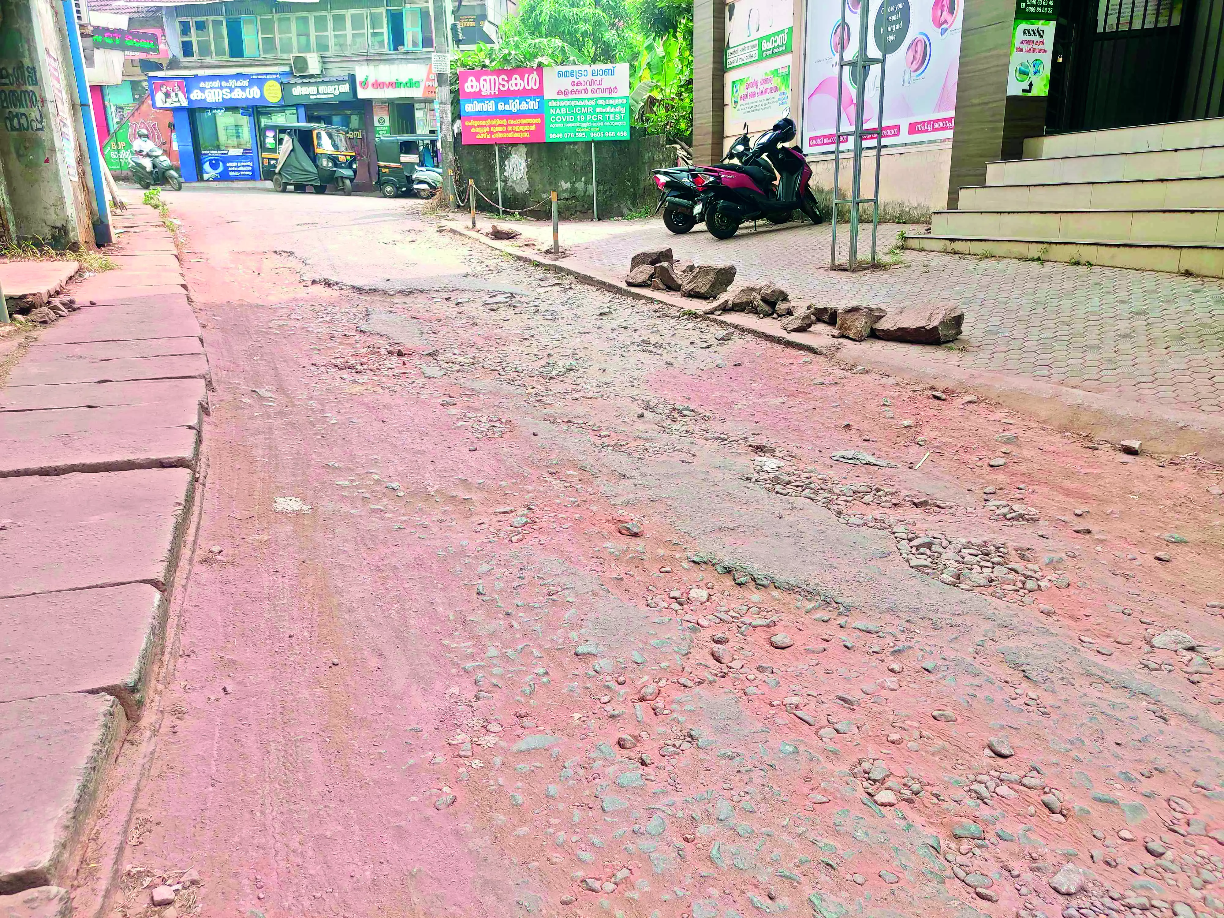 ഒടുവിൽ ഡോക്ടേഴ്സ് കോളനി റോഡിന് ശാപമോക്ഷം; നവീകരണ പ്രവൃത്തി ഞായറാഴ്ച ആരംഭിക്കും