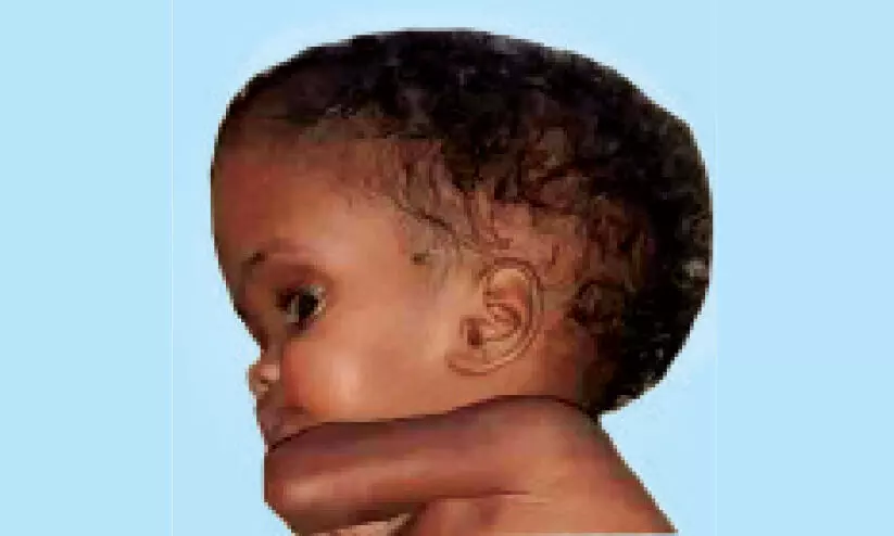 harshitha endosulfan death