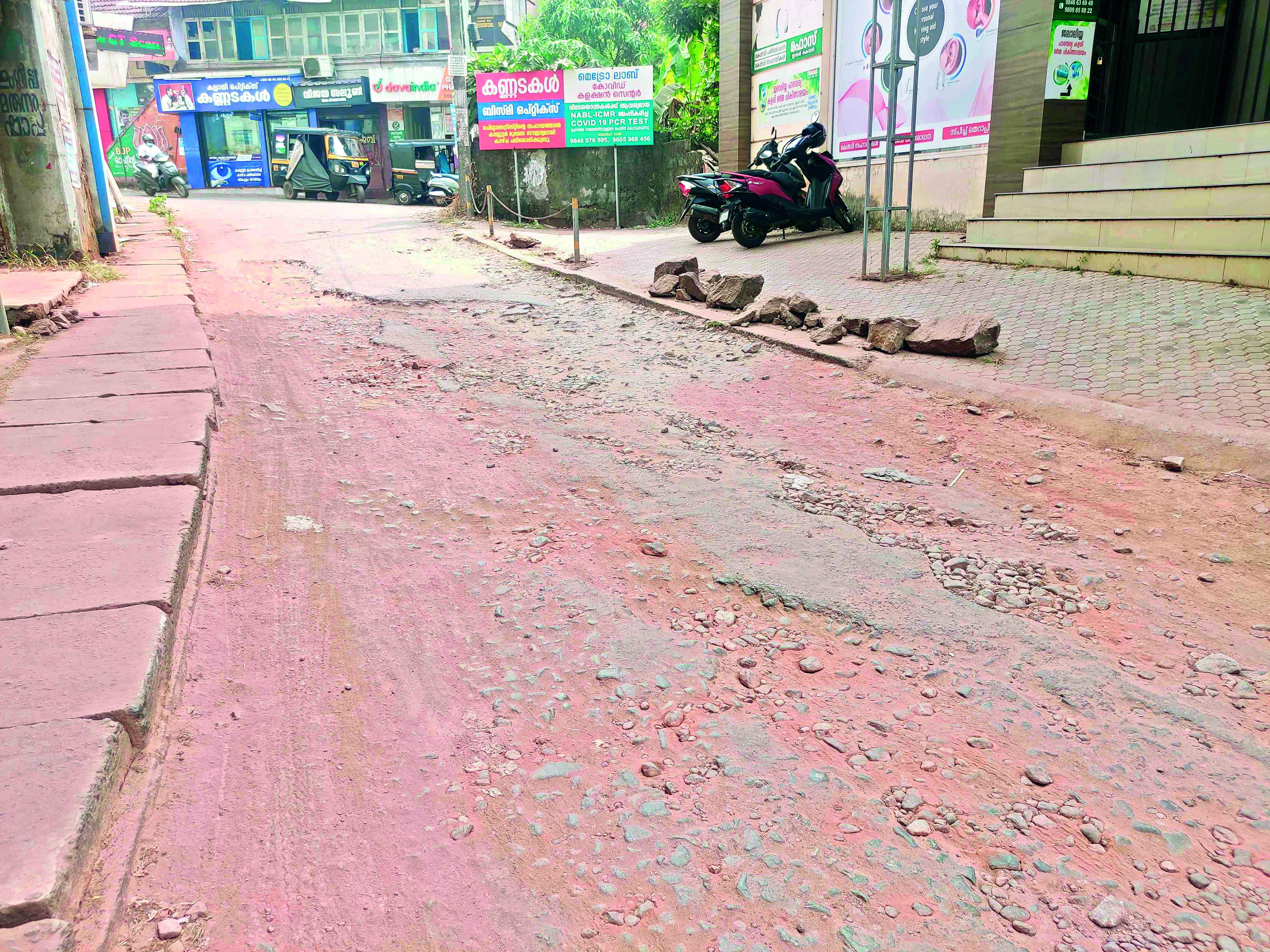 ഒടുവിൽ ഡോക്ടേഴ്സ് കോളനി റോഡിന് ശാപമോക്ഷം; നവീകരണ പ്രവൃത്തി ഞായറാഴ്ച ആരംഭിക്കും