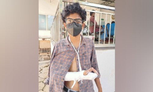 ബൈക്ക് യാത്രികനെ ഇടിച്ചിട്ട് ബസ് നിർത്താതെ പോയി ബൈക്ക് യാത്രികനെ ഇടിച്ചിട്ട് ബസ് നിർത്താതെ പോയി