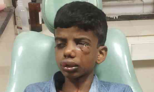ബാലനെ തെരുവുനായ്ക്കൾ ആക്രമിച്ചു