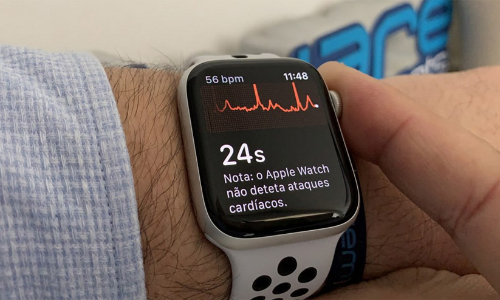 അപകടത്തിൽ പെട്ട് റോഡിൽ രക്തം വാർന്നുകിടന്നു; ജീവൻ രക്ഷിച്ചത് ആപ്പിൾ വാച്ച്, സംഭവം ഇങ്ങനെ...!