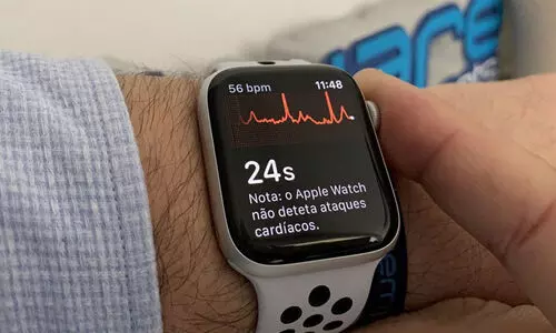 അപകടത്തിൽ പെട്ട് റോഡിൽ രക്തം വാർന്നുകിടന്നു; ജീവൻ രക്ഷിച്ചത് ആപ്പിൾ വാച്ച്, സംഭവം ഇങ്ങനെ...!