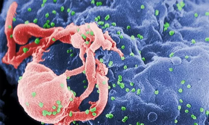 New strain of HIV discovered; The transfer capacity is five and a half times