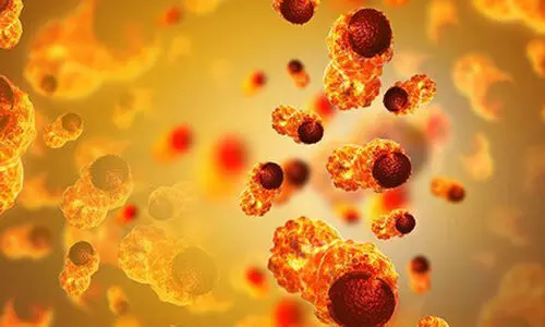 നേരത്തെ കണ്ടെത്തിയാൽ അർബുദത്തെ ഭയക്കേണ്ട