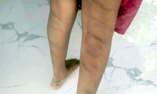 A fourth class girl was allegedly assaulted by a tuition teacher