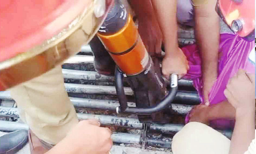 ഗ്രിൽ റോളറിനിടയിൽ പെൺകുട്ടിയുടെ കാൽ കുടുങ്ങി ഗ്രിൽ റോളറിനിടയിൽ പെൺകുട്ടിയുടെ കാൽ കുടുങ്ങി