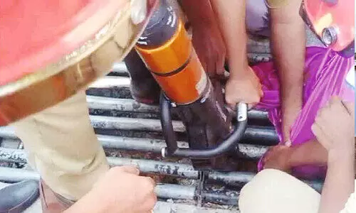 ഗ്രിൽ റോളറിനിടയിൽ പെൺകുട്ടിയുടെ കാൽ കുടുങ്ങി