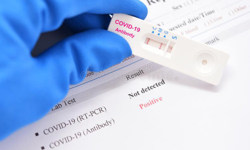 ആർ.ടി.പി.സി.ആർ: അമിത തുക ഈടാക്കിയ നടപടിയിൽ വിശദീകരണം നൽകണമെന്ന്​ കെ.എം.സി.സി ഖത്തർ കമ്മിറ്റി