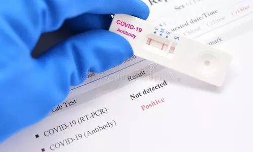 ആർ.ടി.പി.സി.ആർ: അമിത തുക ഈടാക്കിയ നടപടിയിൽ വിശദീകരണം നൽകണമെന്ന്​ കെ.എം.സി.സി ഖത്തർ കമ്മിറ്റി