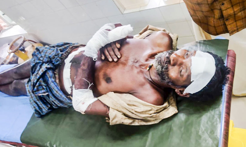 ഒരുവർഷം മുമ്പ്​ ആക്രമിക്കപ്പെട്ടയാൾക്ക്​ വീണ്ടും വെട്ടേറ്റു