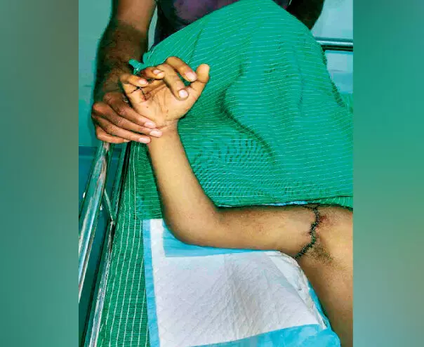 Hand Sewing Young to new life Hand Sewing Young to new life