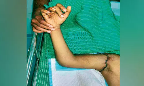 Hand Sewing Young to new life