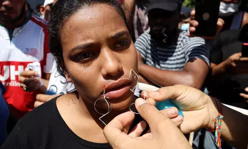 സൂചിയും പ്ലാസ്റ്റിക് നൂലുമുപയോഗിച്ച് ചുണ്ടുകൾ കൂട്ടിക്കെട്ടി മെക്സിക്കൻ അതിർത്തിയിൽ കുടിയേറ്റ പ്രതിഷേധം