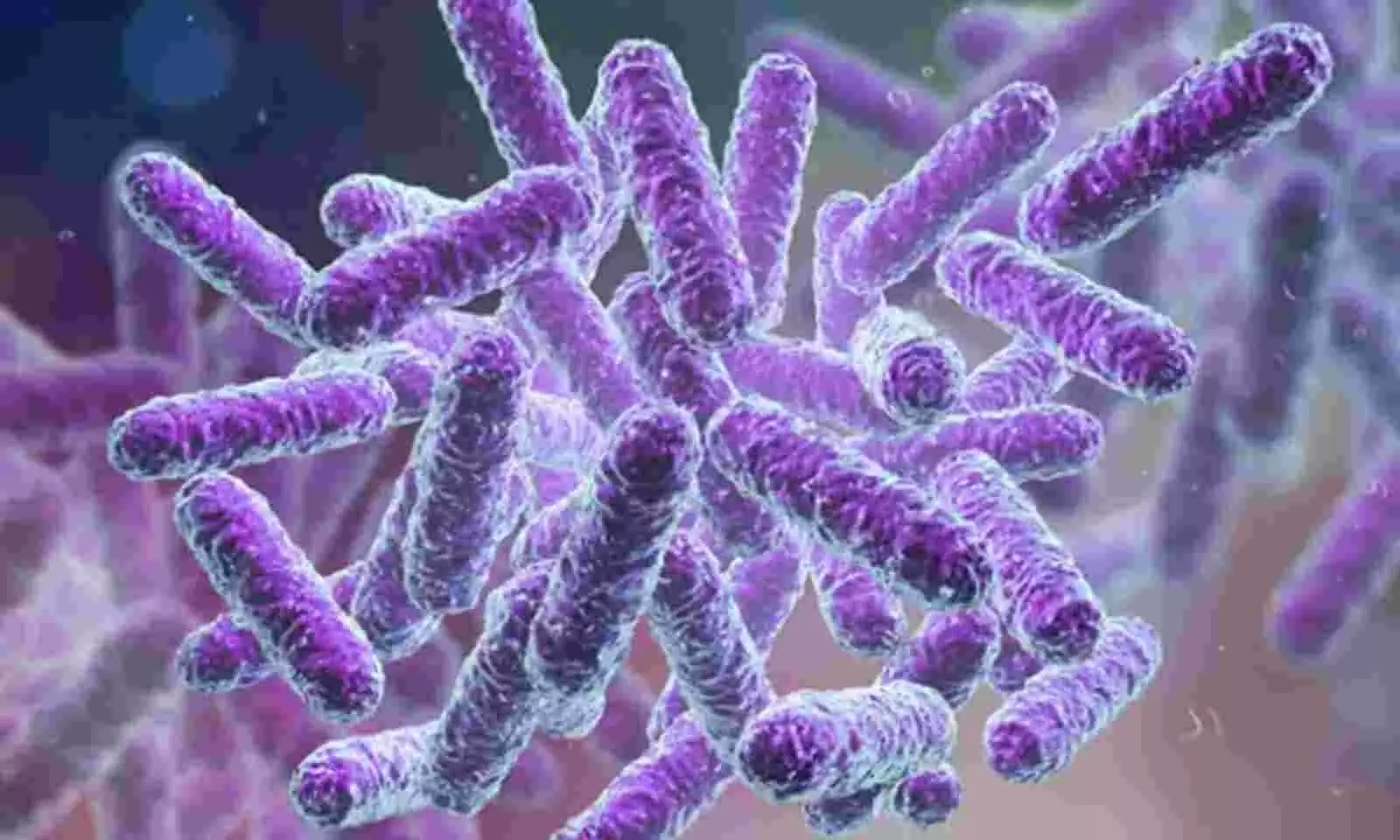 Shigella