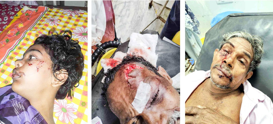 Street dog attack Street dog attack