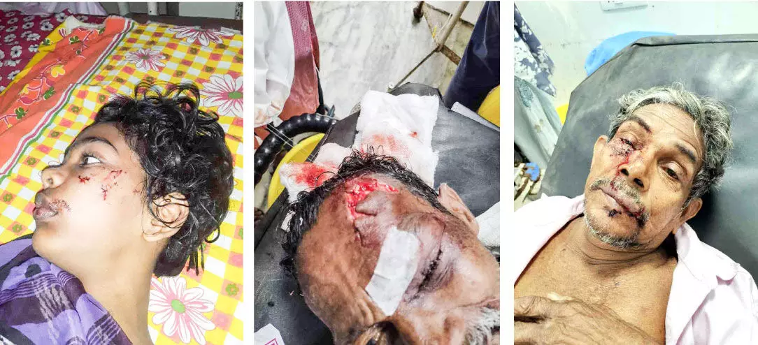 Street dog attack Street dog attack