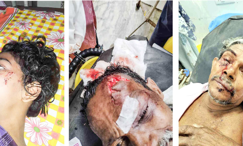 Street dog attack Street dog attack