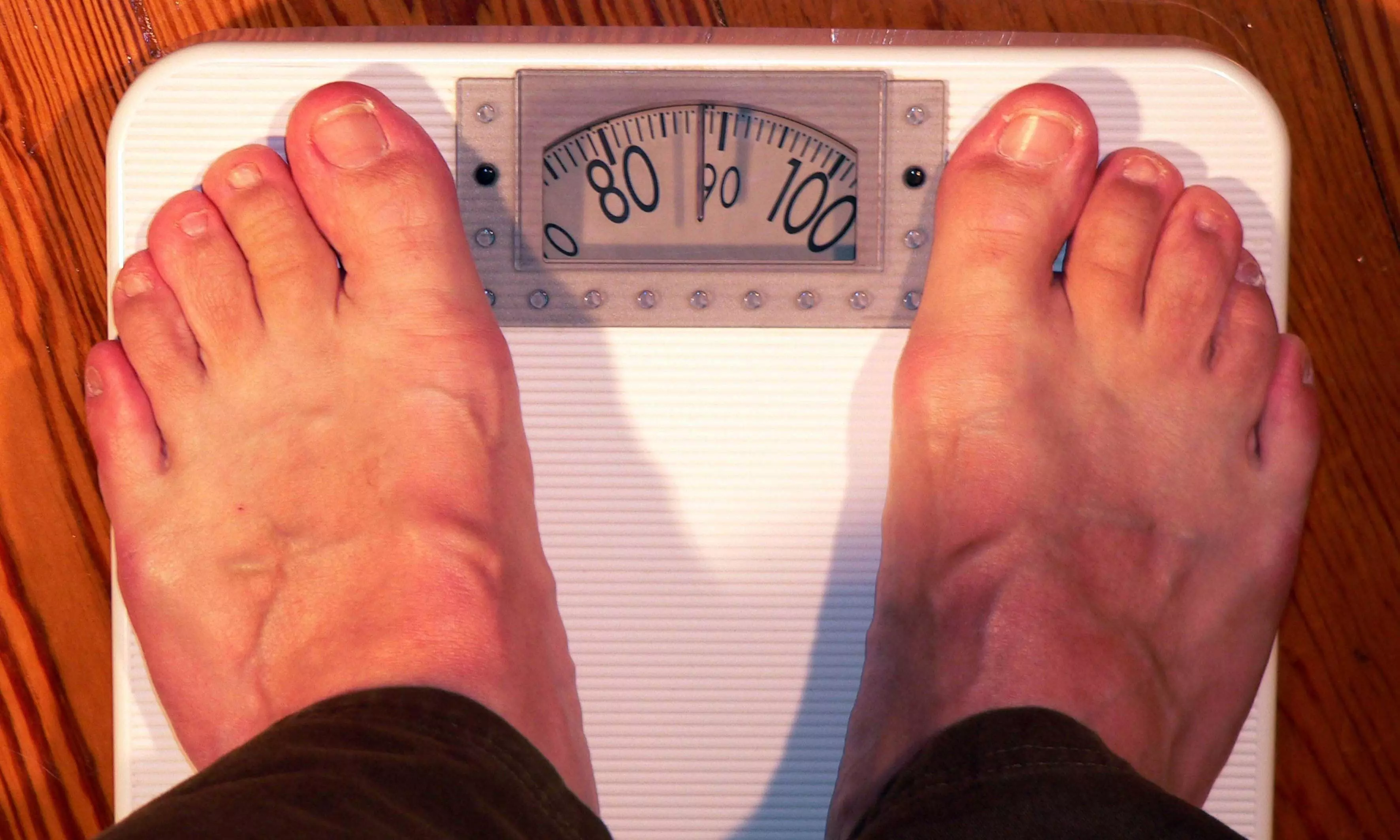 March 4 World Obesity Day March 4 World Obesity Day