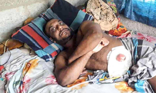 തെങ്ങിൽനിന്ന് വീണ് നട്ടെല്ല് തളര്‍ന്നു; വീ​ടും സ്ഥ​ല​വും വി​റ്റിട്ടും ചികിത്സക്ക് പണം തികഞ്ഞില്ല