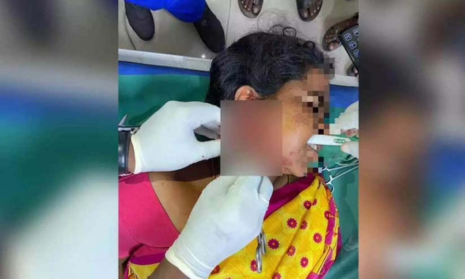 Toothbrush pierced through cheek