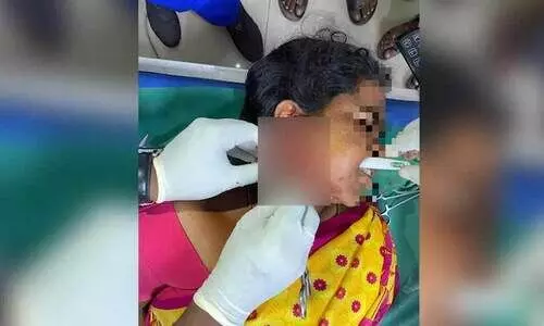 Toothbrush pierced through cheek