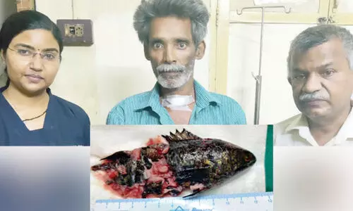 തൊണ്ടയിൽ മീൻ കുടുങ്ങിയ ആളെ രക്ഷപ്പെടുത്തി