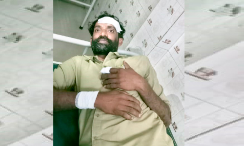 വൈ​ദ്യു​തി പോസ്റ്റിന് മു​ക​ളി​ലി​രി​ക്കെ ലൈ​ൻ​മാ​നെ ക​ല്ലെ​റി​ഞ്ഞ് പ​രി​ക്കേ​ൽ​പി​ച്ചു