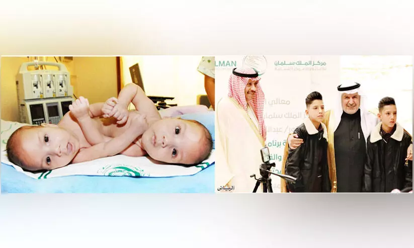 ത​മ്മി​ല​ക​റ്റി​യ​ഡോ​ക്​​ട​റെ തേ​ടി​​ സ​യാ​മീ​സ്