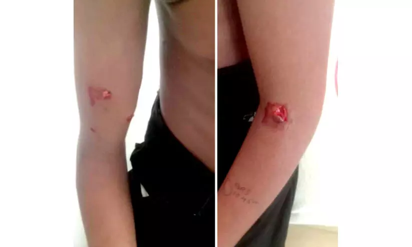 തെരുവുനായുടെ ആക്രമണം; ആറാംമൈലിൽ മൂന്നു പേർക്ക് കടിയേറ്റു തെരുവുനായുടെ ആക്രമണം; ആറാംമൈലിൽ മൂന്നു പേർക്ക് കടിയേറ്റു